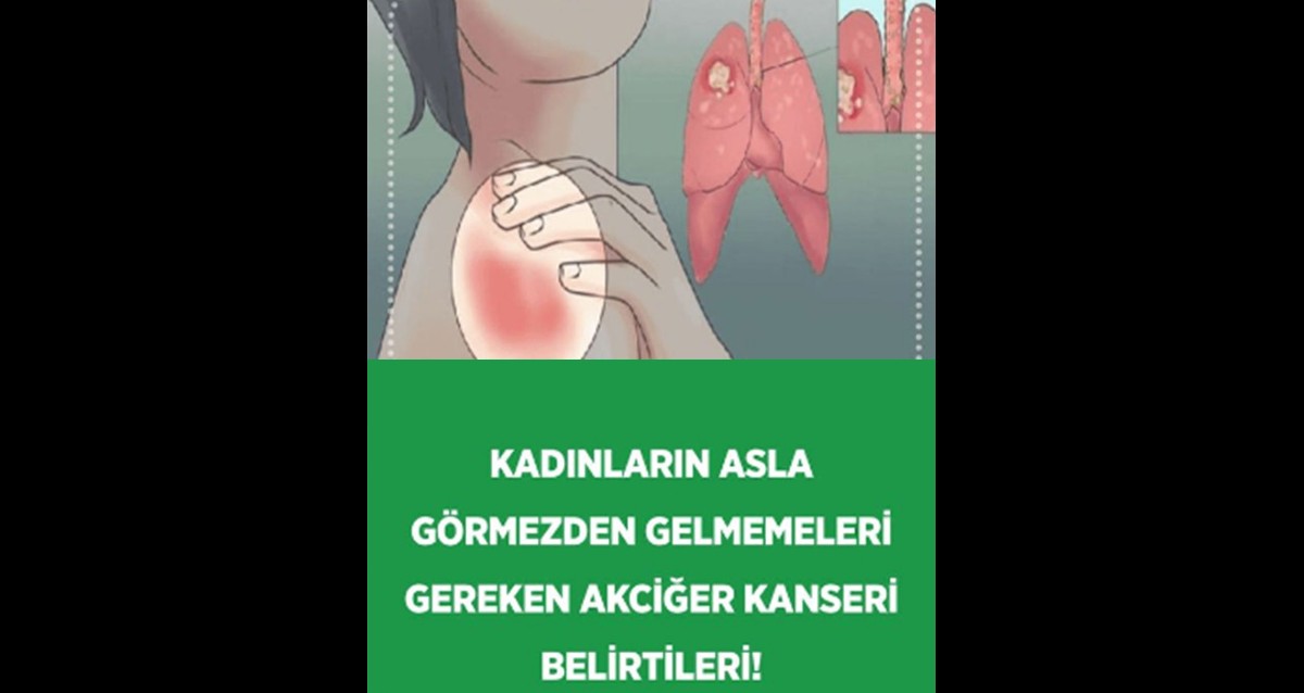 Kadınlarda akciğer kanserinin belirtileri nelerdir...